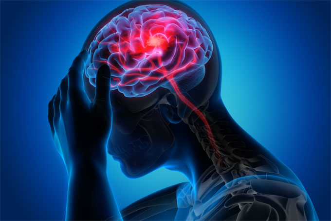 Supporting collaborative research for people with brain injury and their carers.